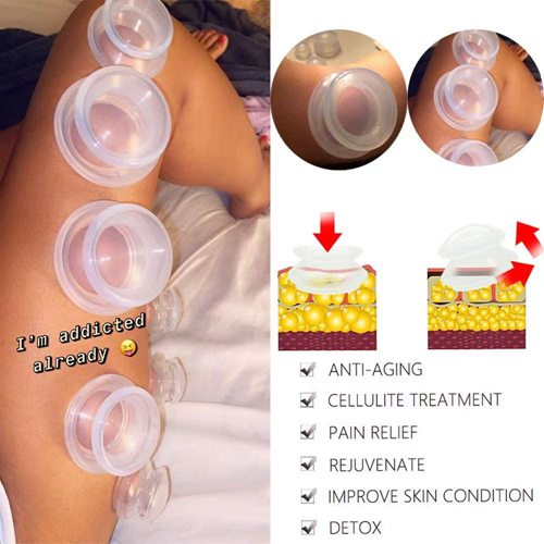 6 Cups Strong suction Silicone cupping set